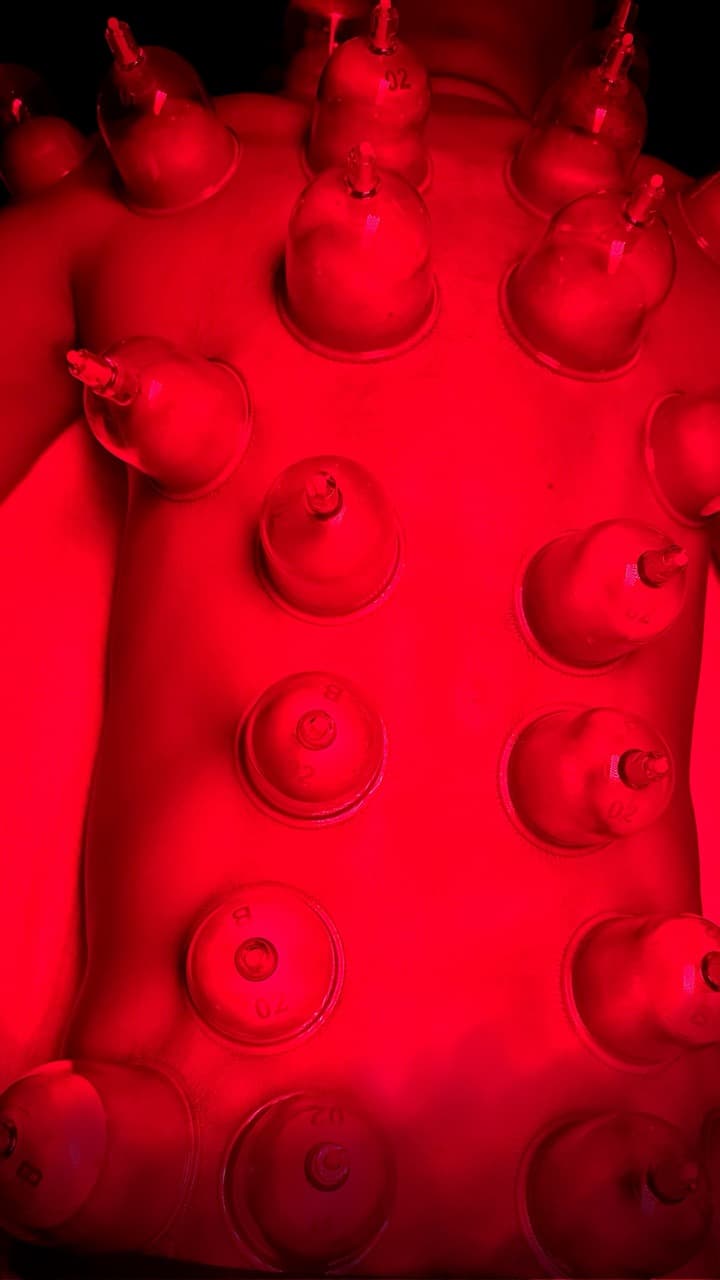 Lumino Cupping